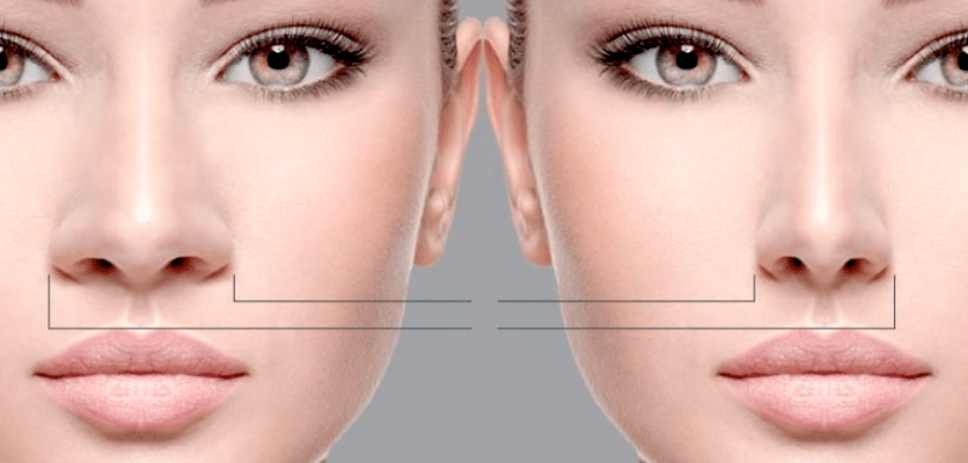 Gerenciamento de beleza facial é aliado para evitar erros e reversão da harmonização facial